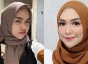 Benarkah Operasi Hidung Ria Ricis Menghabiskan Ratusan Juta Rupiah? Simak Penjelasannya!