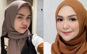 Benarkah Operasi Hidung Ria Ricis Menghabiskan Ratusan Juta Rupiah? Simak Penjelasannya!