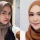 Benarkah Operasi Hidung Ria Ricis Menghabiskan Ratusan Juta Rupiah? Simak Penjelasannya!