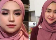 Ria Ricis Akui Oplas Hidung, Wajah Baru Pecah Telur Netizen di Hari Kartini 2026