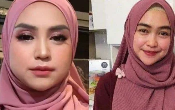Ria Ricis Akui Oplas Hidung, Wajah Baru Pecah Telur Netizen di Hari Kartini 2026