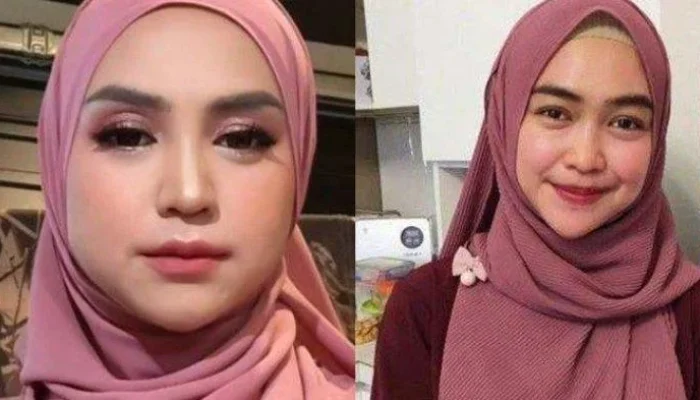 Ria Ricis Akui Oplas Hidung, Wajah Baru Pecah Telur Netizen di Hari Kartini 2026