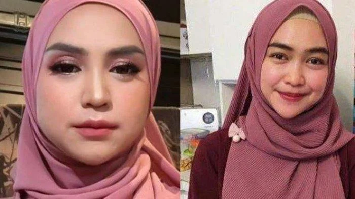 Ria Ricis Akui Oplas Hidung, Wajah Baru Pecah Telur Netizen di Hari Kartini 2026