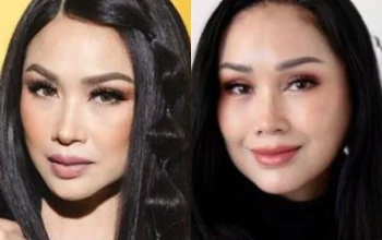 Rossa Luncurkan Somasi Tegas: Puluhan Akun Sosmed Dituntut Hapus Fitnah Operasi Plastik