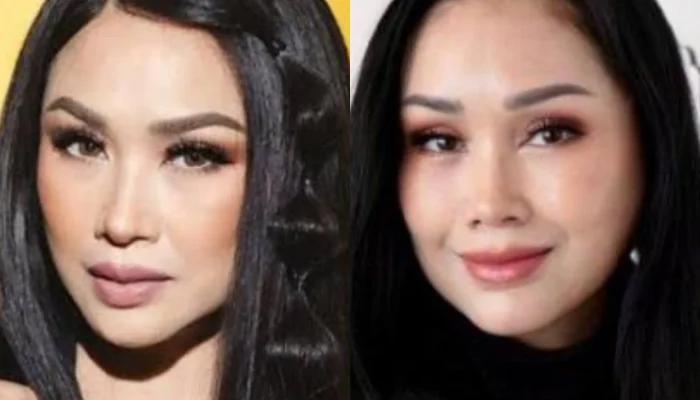 Rossa Luncurkan Somasi Tegas: Puluhan Akun Sosmed Dituntut Hapus Fitnah Operasi Plastik