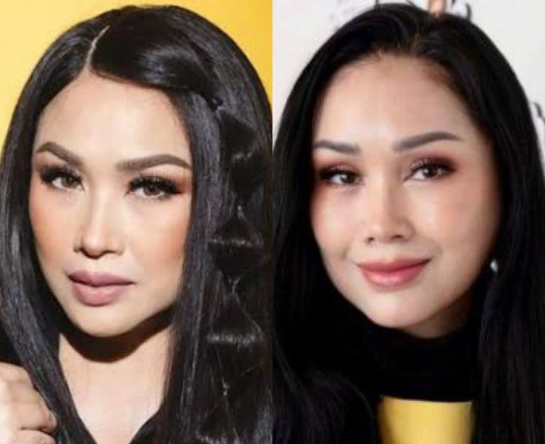 Rossa Luncurkan Somasi Tegas: Puluhan Akun Sosmed Dituntut Hapus Fitnah Operasi Plastik