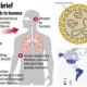 Gejala dan Tanda Bahaya Hantavirus yang Tewaskan 3 Orang di Kapal Pesiar MV Hondius