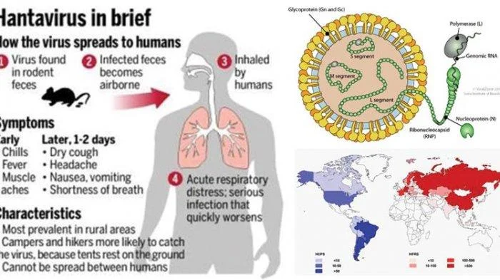 Gejala dan Tanda Bahaya Hantavirus yang Tewaskan 3 Orang di Kapal Pesiar MV Hondius