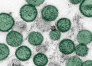 Misteri Hantavirus di Kapal Pesiar MV Hondius: Tiga Korban, Penularan, dan Upaya Penanggulangan