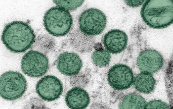 Misteri Hantavirus di Kapal Pesiar MV Hondius: Tiga Korban, Penularan, dan Upaya Penanggulangan