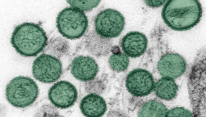 Misteri Hantavirus di Kapal Pesiar MV Hondius: Tiga Korban, Penularan, dan Upaya Penanggulangan