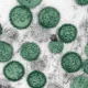 Misteri Hantavirus di Kapal Pesiar MV Hondius: Tiga Korban, Penularan, dan Upaya Penanggulangan