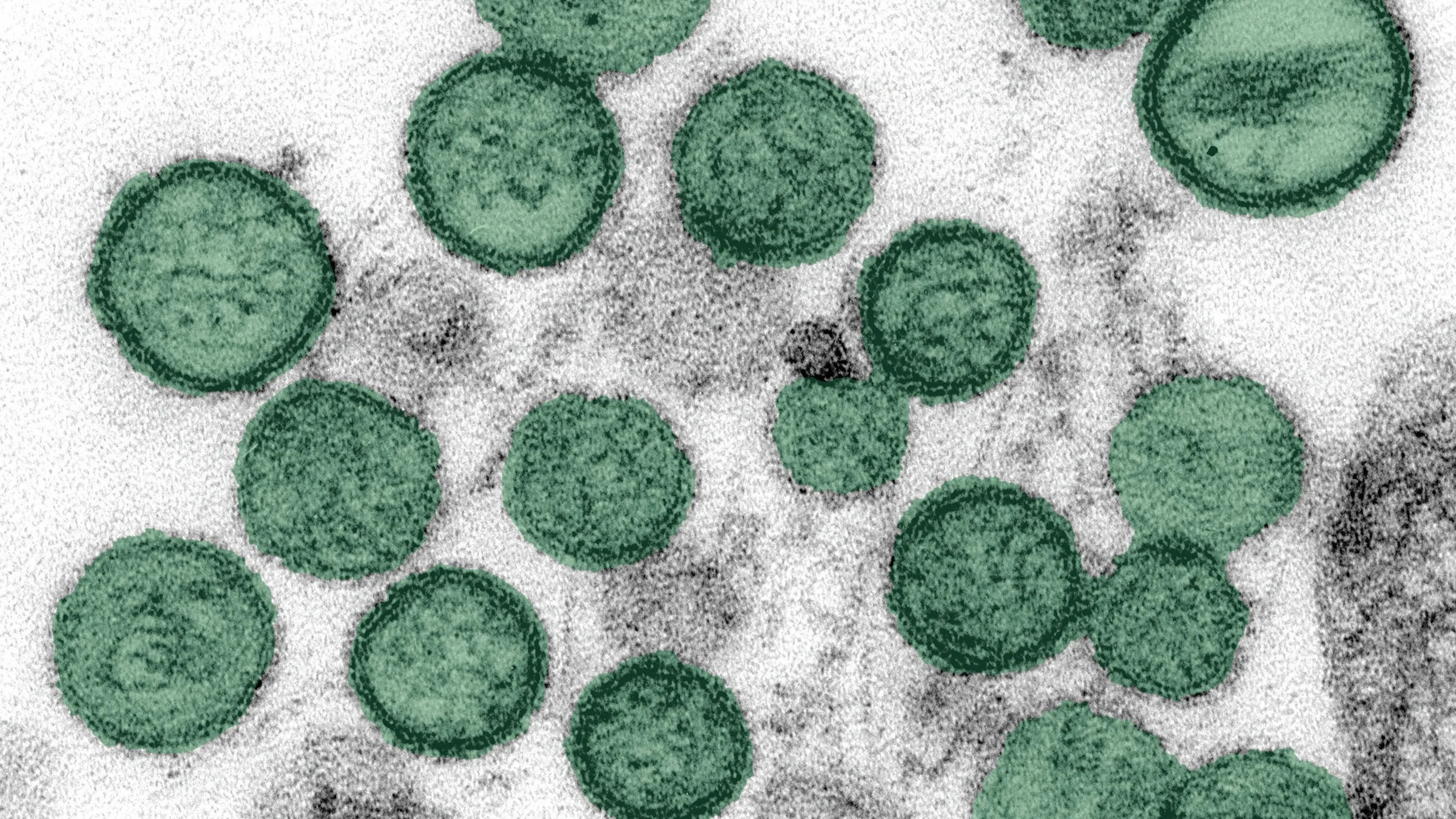Misteri Hantavirus di Kapal Pesiar MV Hondius: Tiga Korban, Penularan, dan Upaya Penanggulangan