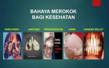 Kanker: Ancaman Serius yang Mengintai, Bahaya Merokok, dan Gejala Brain Fog