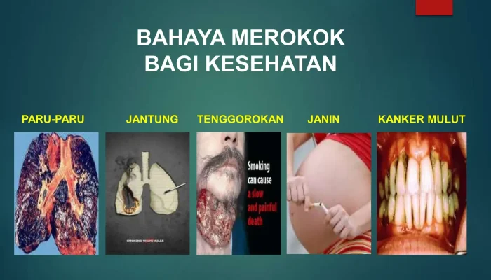 Kanker: Ancaman Serius yang Mengintai, Bahaya Merokok, dan Gejala Brain Fog