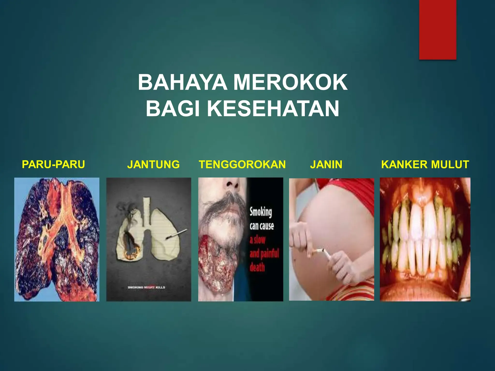 Kanker: Ancaman Serius yang Mengintai, Bahaya Merokok, dan Gejala Brain Fog