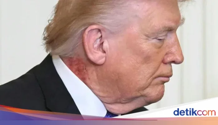 Trump Dalam Sorotan: Dari Pendidikan hingga UFC, Apa yang Sedang Terjadi?
