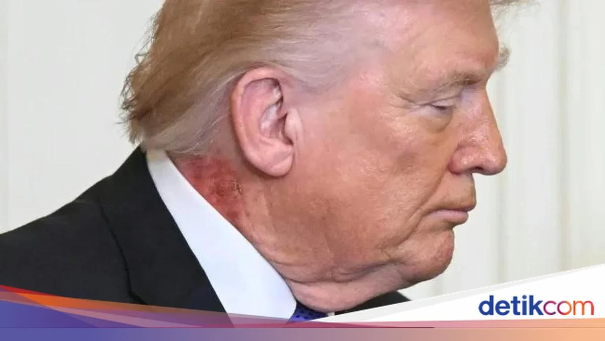 Trump Dalam Sorotan: Dari Pendidikan hingga UFC, Apa yang Sedang Terjadi?