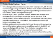 Jimothy dan Teman-Temannya: Mengenal Sindrom Spina Pendek